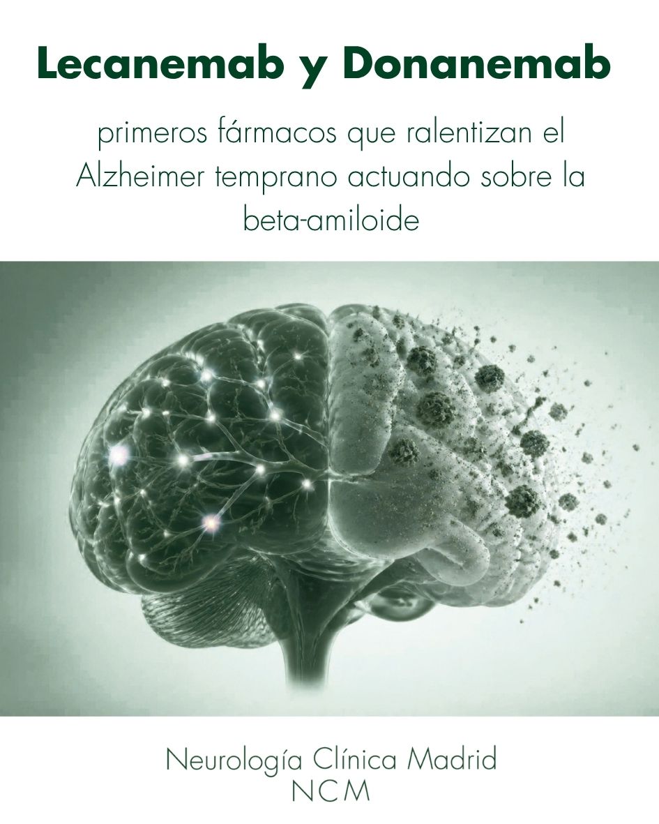 Lecanemab y Donanemab